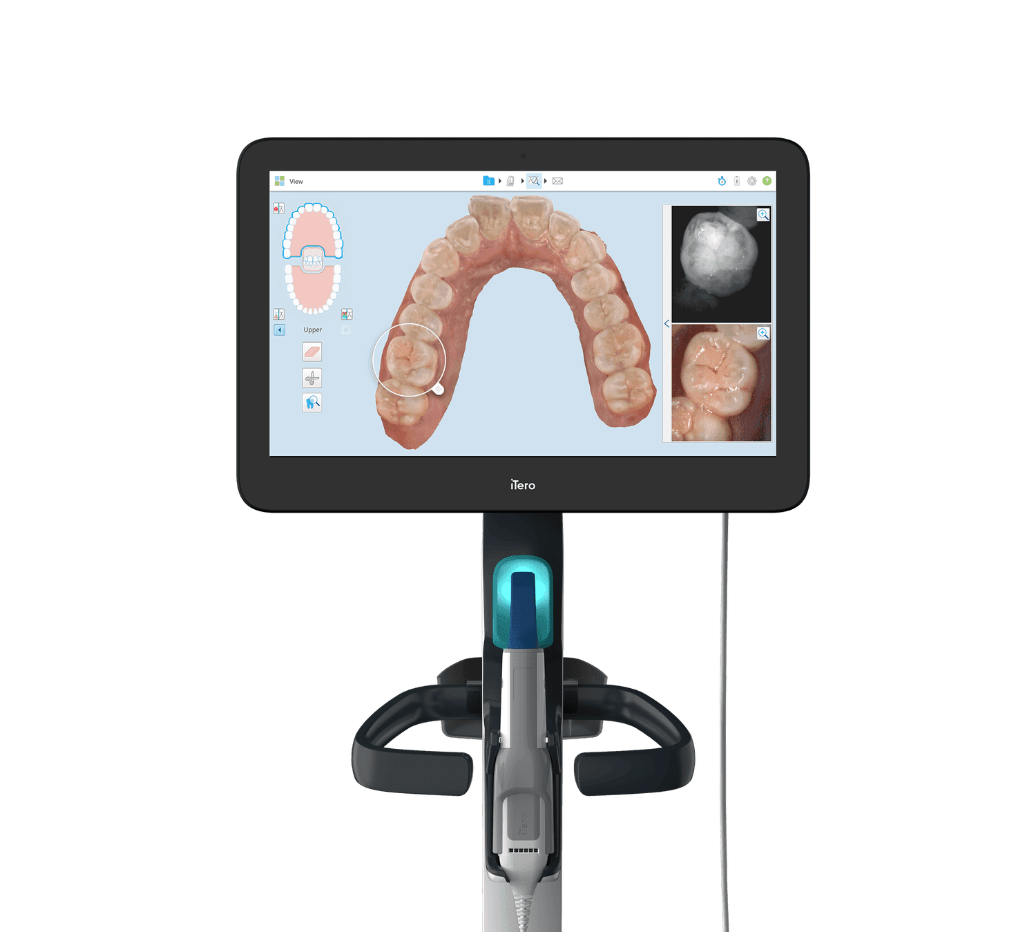 An intraoral scanner showing a full-arch scan on its screen