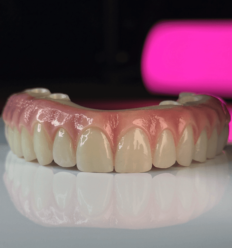 A full-arch restoration photographed on the bench under studio light